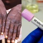 Fièvre de la vallée du Rift et Mpox : 277 cas et 22 décès enregistrés au Sénégal, alerte du ministère de la Santé